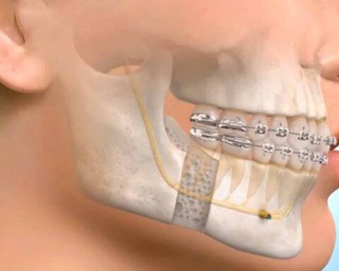 Oral Maxillofacial Surgery
